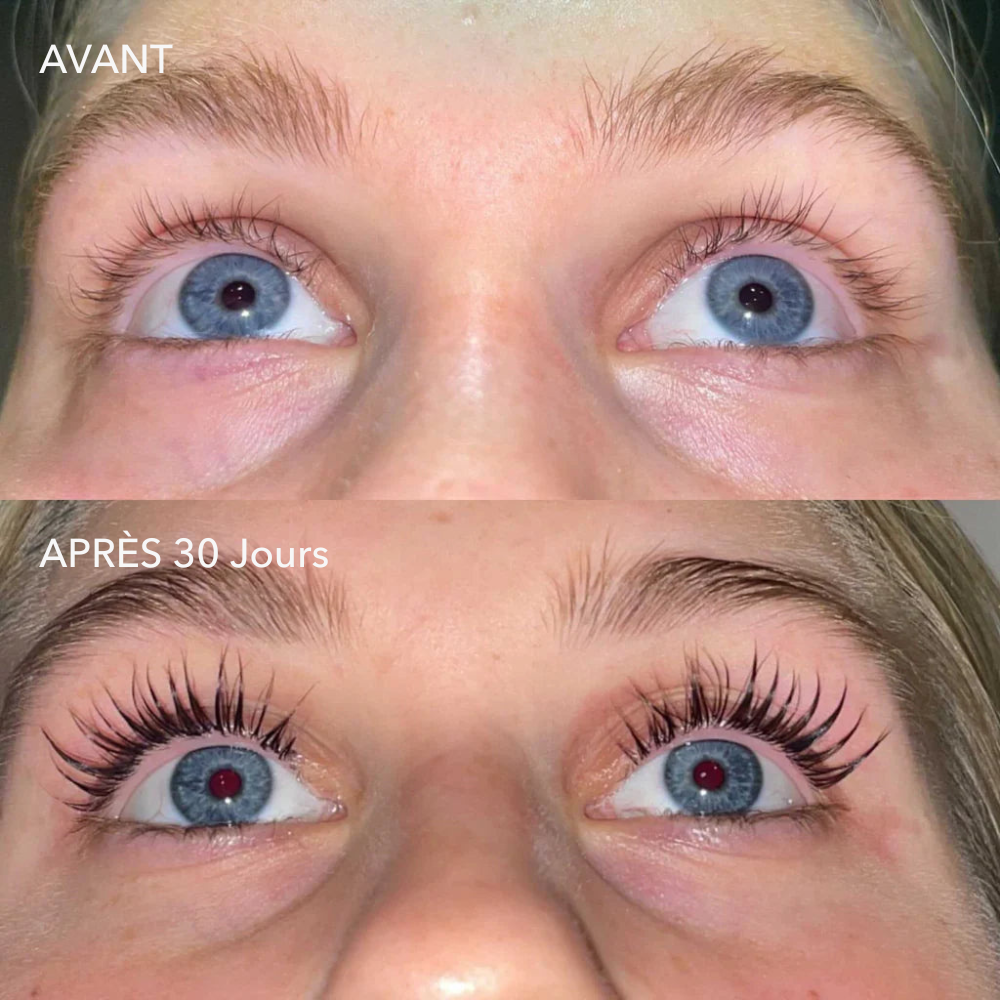 Sérum de Croissance pour Cils (1 Acheté = 1 OFFERT)